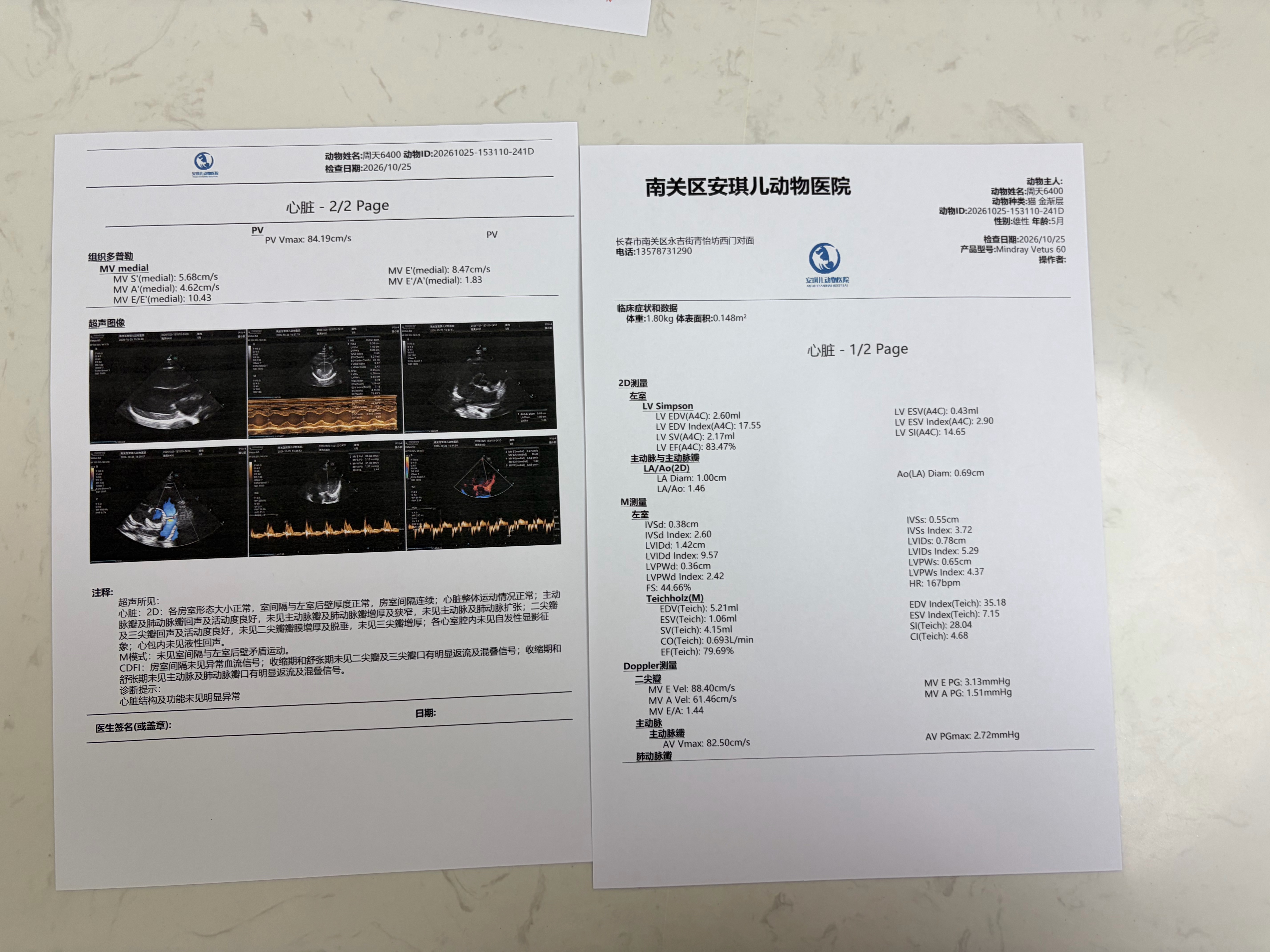抗体检测合格，心超正常